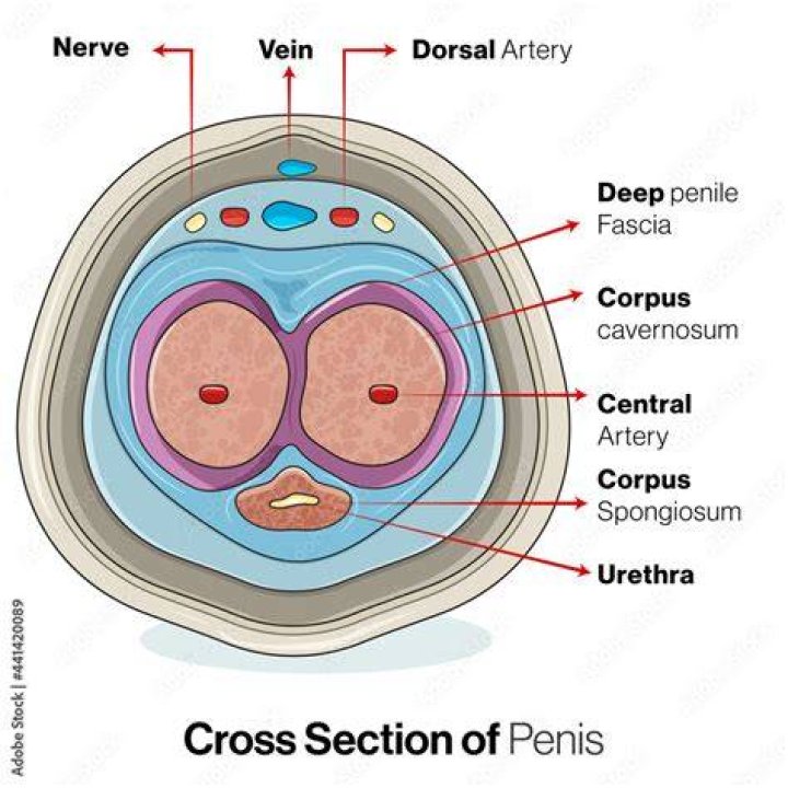 Dick Vitale cancer: What type of cancer did Dick Vitale have? 1 Dick