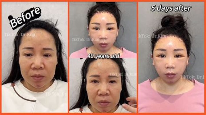 Dr. Kim plastic surgery TikTok, explained