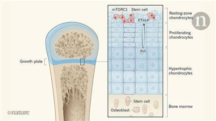 Newly Discovered Bone Stem Cell Causes Premature Skull Fusion